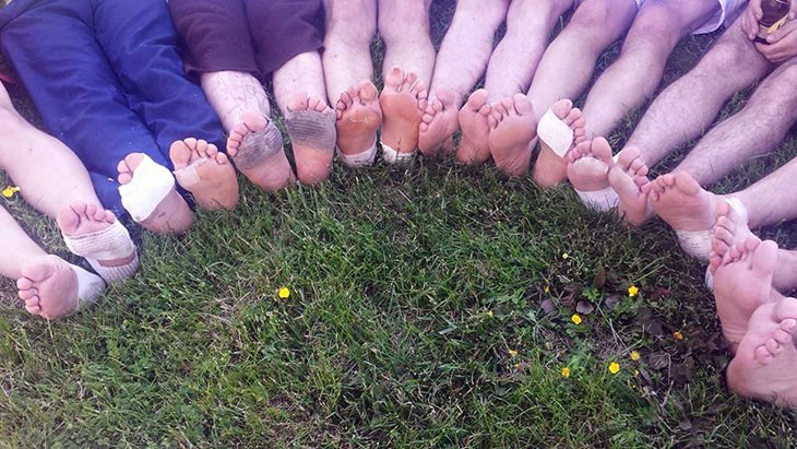 Les pieds des marcheurs, meurtris par les chaussures.